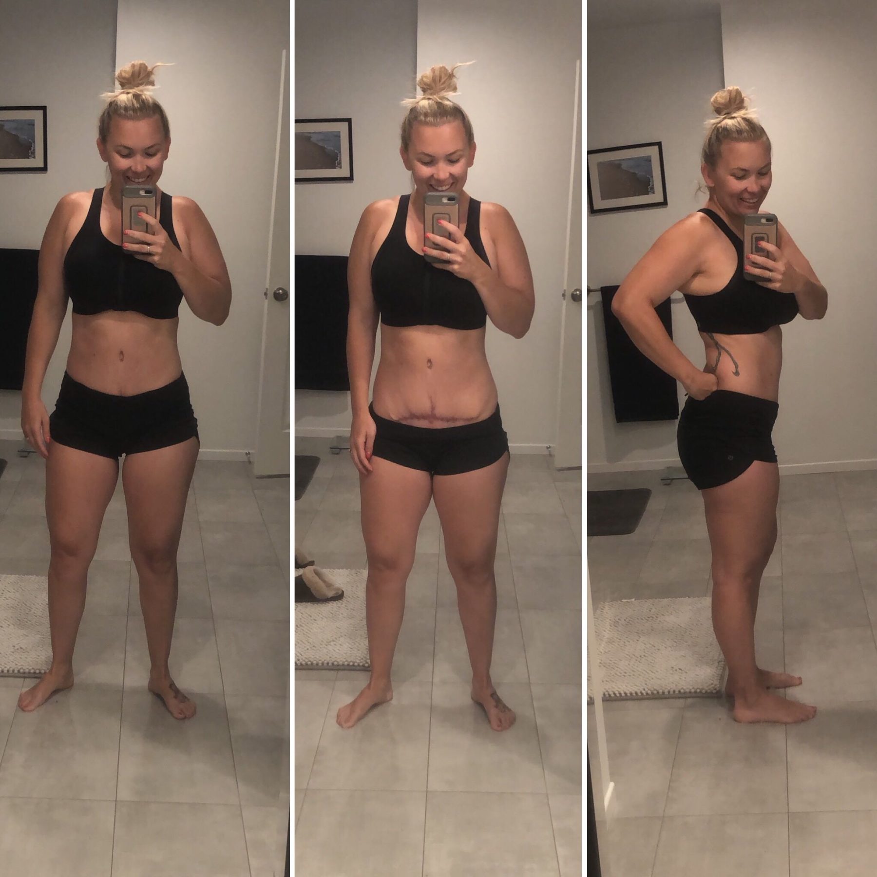 A 6w postpartum update after Tummytuck! Let me know if you have